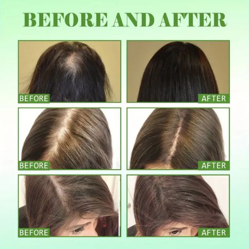 60ml Rosemary Mint Scalp And Hair Strengthening Oil, Hair Care Serum For All Hair Types, Healthy Hair Penetrates Root To Tip